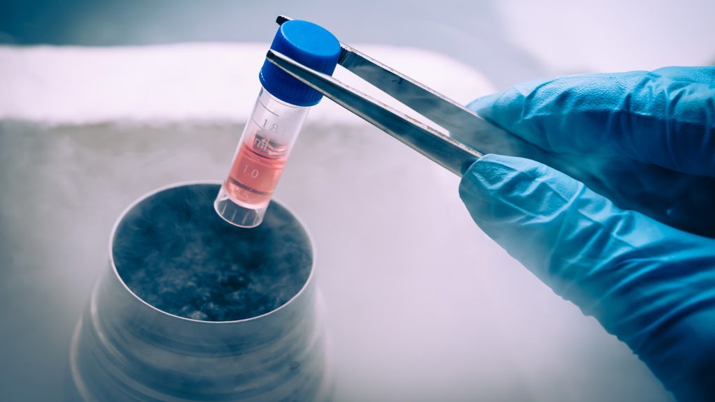 person håller i ett provrör och gör ett test