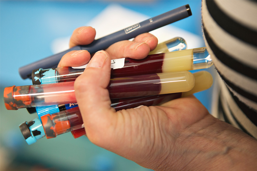 Blodprover från TEDDY studien